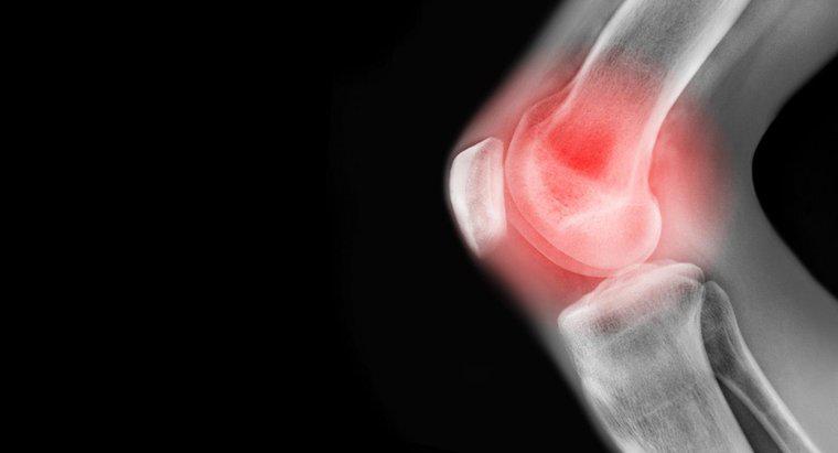 Was sind einige Ursachen für Schmerzen im linken Knie?