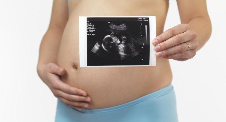 Kann ein 5 Monate alter Fötus außerhalb der Gebärmutter überleben?