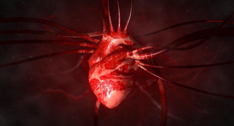 Was ist eine vergrößerte Arterie vom Herzen?