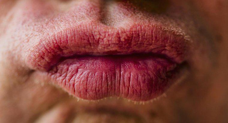 Wie behandelt man aufgrund einer Allergie geschwollene Lippen?
