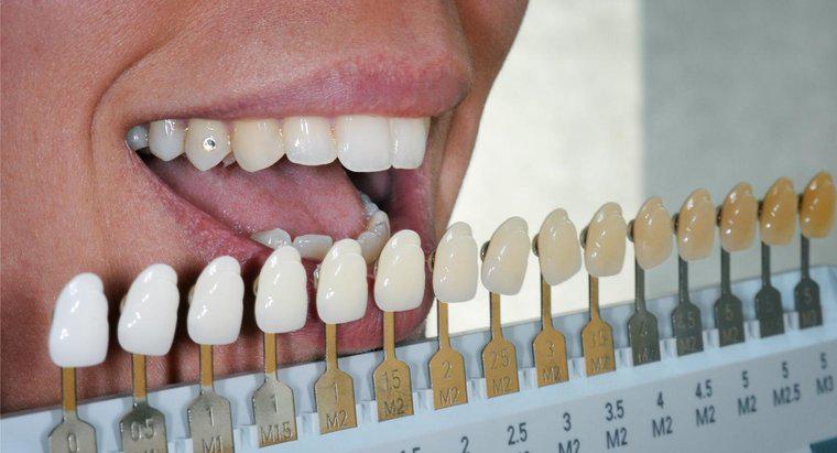Können künstliche Zähne aufgehellt werden?