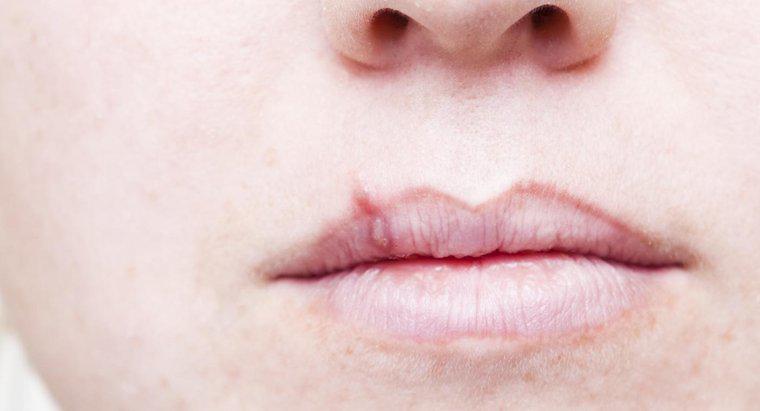 Wie lange dauern Lippenherpes bei der Anwendung von Abreva?