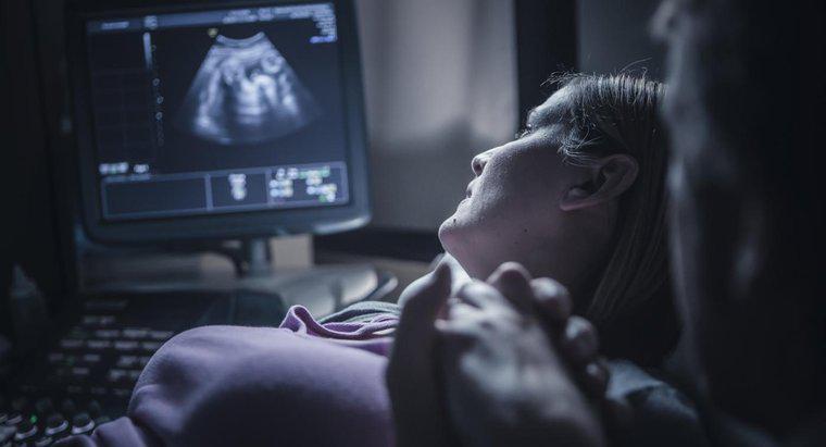 Wie weit müssen Sie sein, um den Herzschlag eines Babys während eines Ultraschalls zu hören?