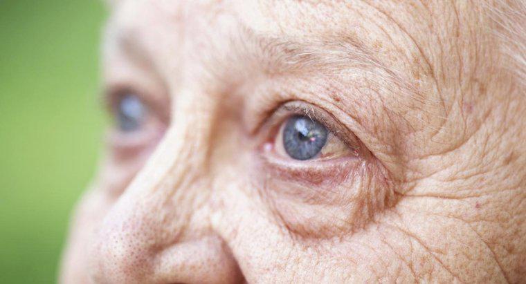 Warum verschlechtert sich das Sehvermögen mit dem Alter?