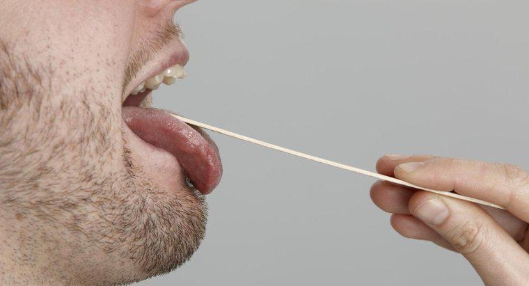 Welcher Arzt ist am besten geeignet, um ein Problem mit der Zunge zu behandeln?