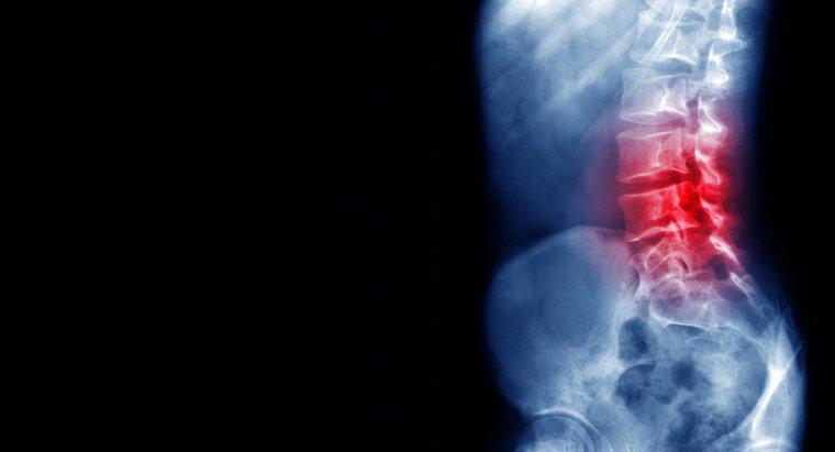 Was sind Ursachen für Schmerzen im unteren Rücken?