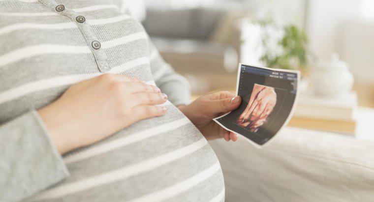 Was ist eine normale Herzfrequenz für ein Baby im Mutterleib?