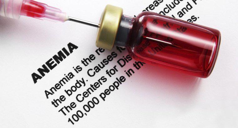 Wie können Sie Blutbildwerte auf Anämie testen?