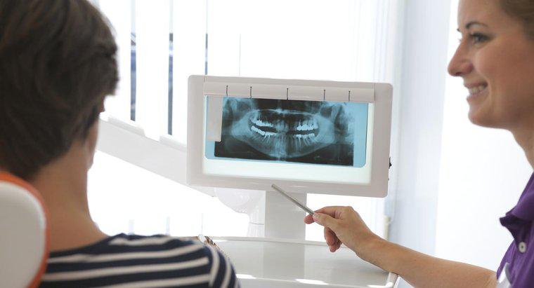 Wie viel muss ich für Zahnimplantate erwarten?